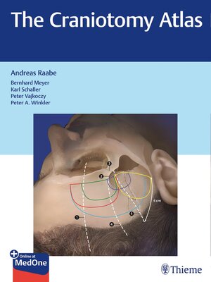 cover image of The Craniotomy Atlas